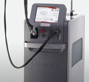 candela gentlemax laser hair removal machine