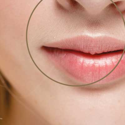 lip laser hair removal soho nyc